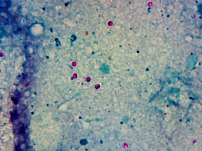 parazity parazitolog